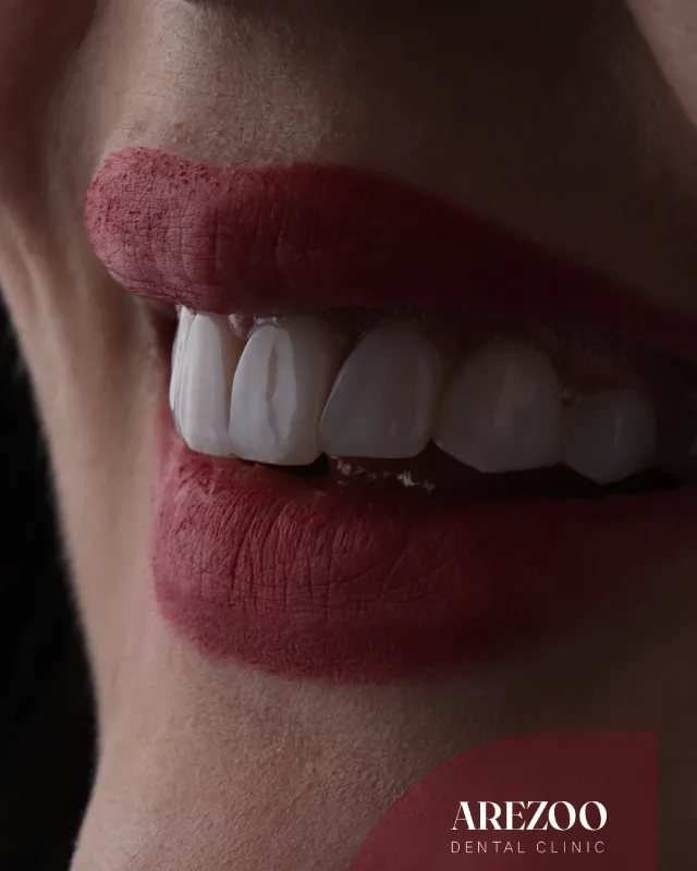 چرا کلینیک دندانپزشکی آرزو را انتخاب کنیم؟